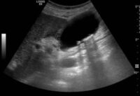 Ultraschallkurs Abdomen